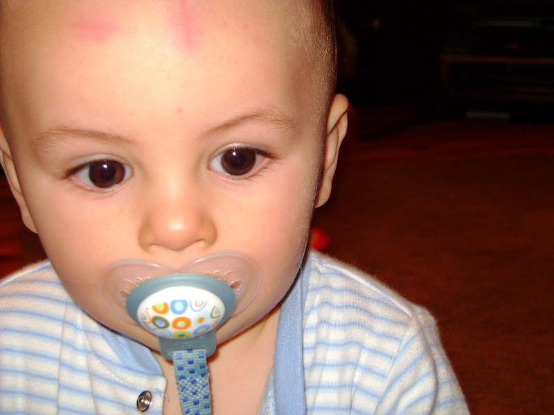 Laudermilks Bumps and Bruises